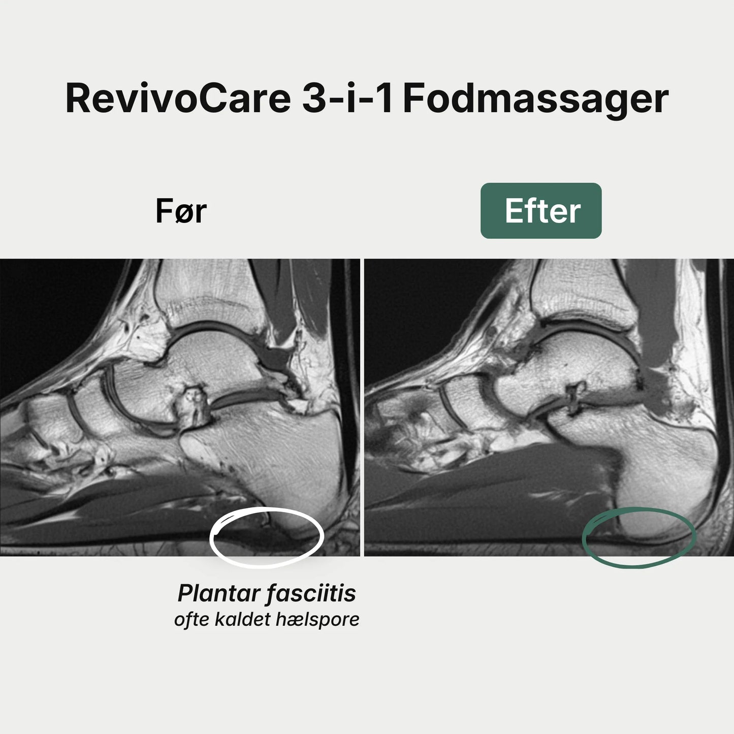 RevivoCare 3-i-1 Fodmassager