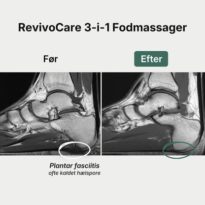 RevivoCare 3-i-1 Fodmassager